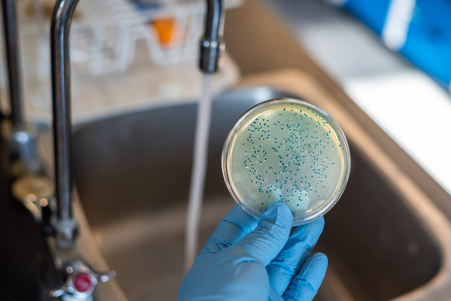 Бактерии разлагающие пластик. Микробы в воде. Кишечные бактерии в воде. Кишечные бактерии в воде. Термотолерантные бактерии.